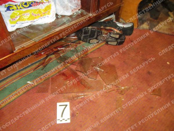 вырезали глаза. гомель 2014 трагедия спайсами. гомель 2014 трагедия спайсами. гомельчанин которому вырезали глаза. выкололи глаза спайс гомель.