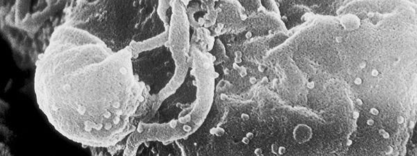 atlante83's tweet image. Crean un preservativo que desactiva el VIH y otros virus de transmisión sexual 
 buff.ly/1sJIGiC