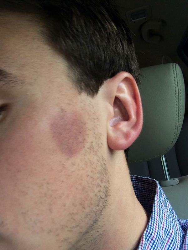 Reece Henson tweet media