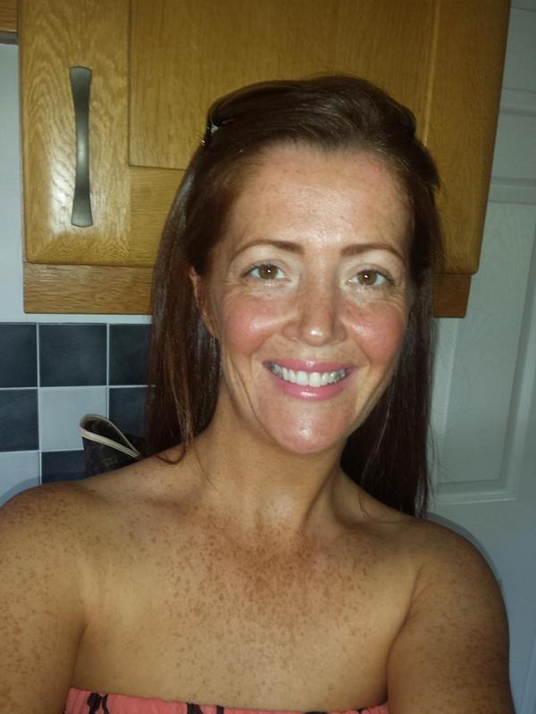 LauraMackay7's tweet image. Freckles OOT! #summerissues