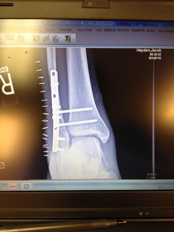 jebbyhay's tweet image. X ray. #thebionicman