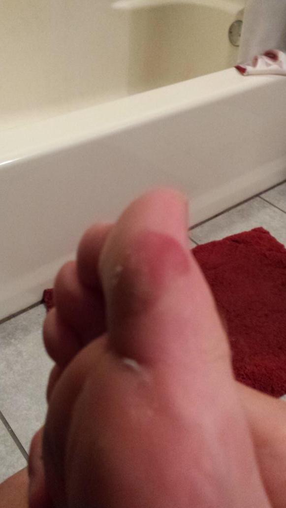 asickel28's tweet photo. Gotta love soccer! This pain was totally worth it! #Greatness http://t.co/fen4ju96uB