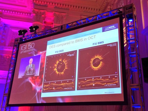 VIVAPhysicians's tweet image. Laird: Catheter based intervention came a long way. The first days had many complications #dottering #cardiology
