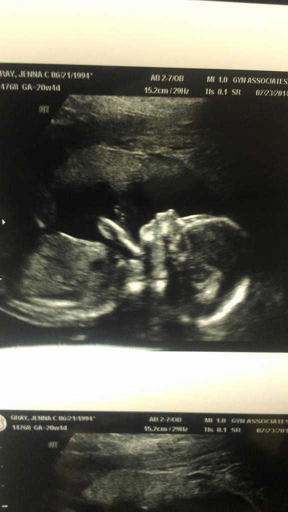 _MeganItNasty's tweet photo. Aw the ittle baaaby girl http://t.co/B4XbnX4ajR