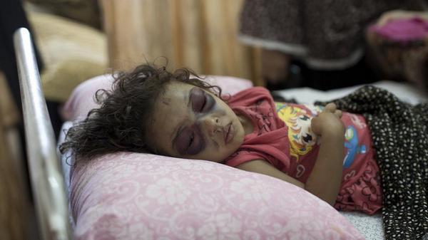 lady_nicsta's tweet photo. @BarackObama @David_Cameron
Wen will u help? #Menwithoutsouls #Gaza
2yr old Palestinian girl Naama Abu al-Foul http://t.co/oc30kmLaCn