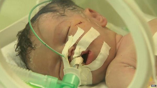 BBC News (World) tweet media