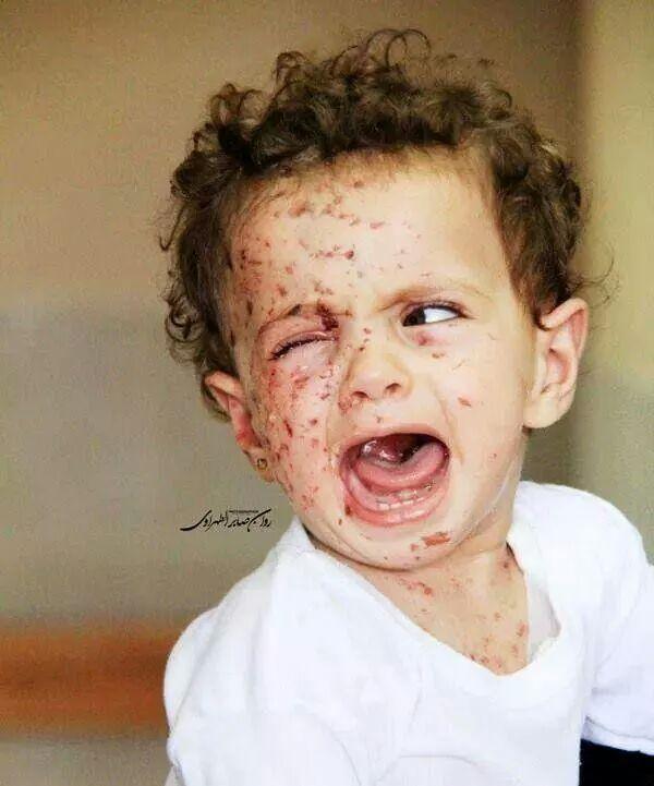 Hasans's tweet photo. #Israeli targets in #gaza #GazaUnderAttack @SavetheChildren #SaveGaza #SaveChildrenInGaza http://t.co/2C90DdFlvQ