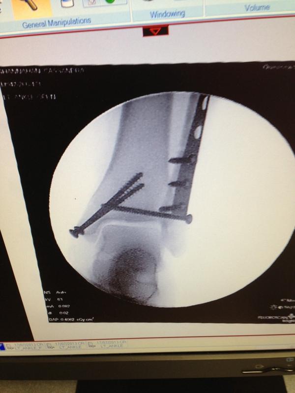 gravystacks's tweet image. #throwbackfriday #serioushardware