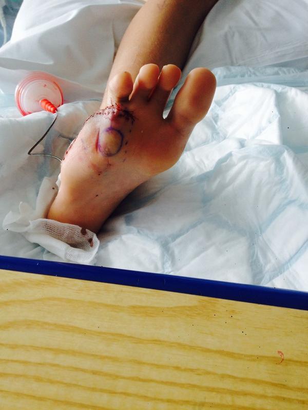 EHepton's tweet photo. #NOWTVPS4 I have recently had an operation on my foot and had my toe amputated and i need a new thing to play http://t.co/MMMerYHD4o