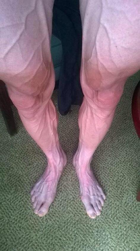 VinceCauchon's tweet image. Voici les jambes de Bartosz Huzarski après la 18e étape au Tour de France. Ces gars-là sont différents.