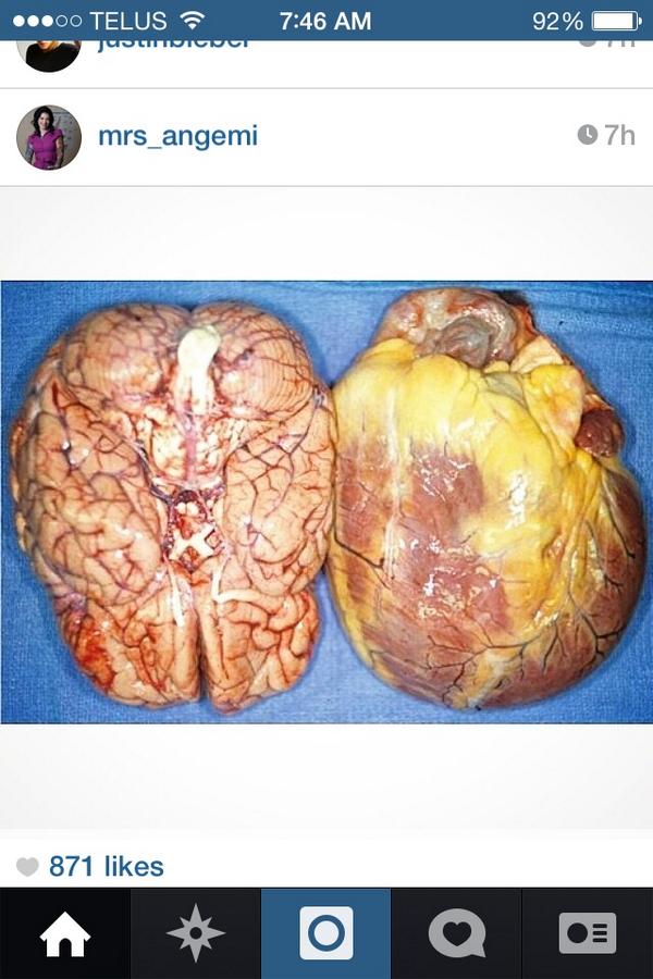 FuturePreMed's tweet photo. Ahh, that's a huge heart! 😁 photo: mrs_angemi on instagram. http://t.co/6BReGYPMjl