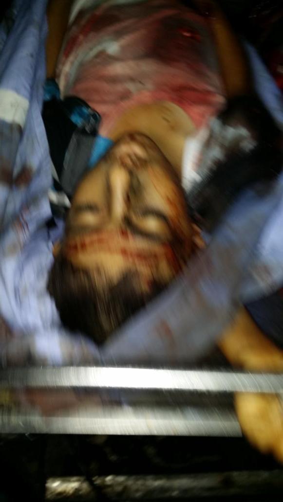 ManuPineda's tweet photo. AVISO: IMÁGENES MUY DURAS DE NIÑOS ASESINADOS EN EL ATAQUE A UN PARQUE INFANTIL,  EN LA MORGUE DE SHIFA HOSPITALn http://t.co/2eLB0qwLjc
