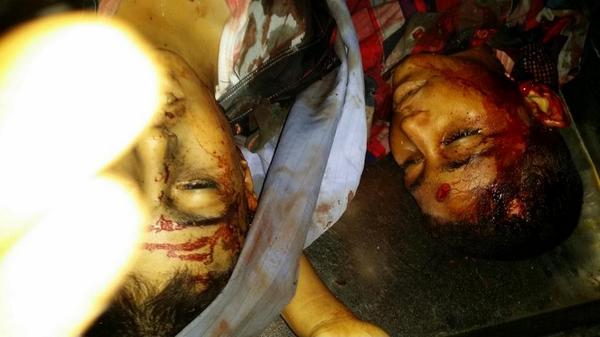 AVISO: Imágenes duras de niños asesinados en el parque infantil en la morgue de Hospital, Shifa.
@Manu_Abu_Carlos