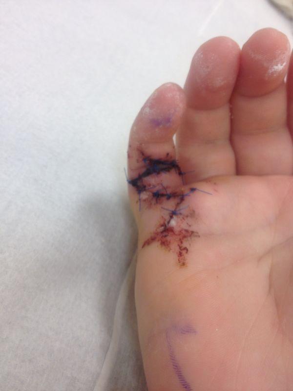 Amanda_mch's tweet photo. @RachelMFI hope so, this happened :( http://t.co/BeeC5DWjsm