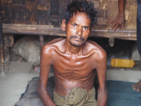 #Myanmar #Rohingya #Muslims trapped in concentration camps fall victim to disease and hunger wapo.st/WLK0Vo
