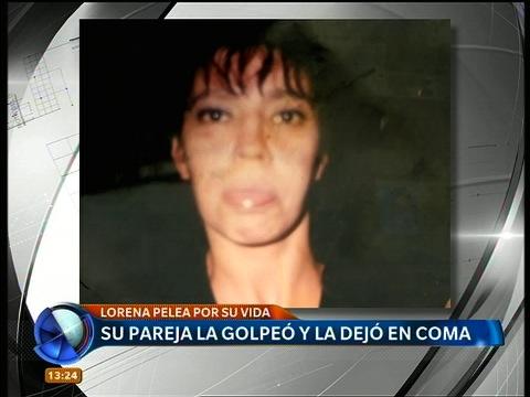 telefenoticias's tweet photo. Su pareja la golpeó y la dejó en coma. Lorena pelea por su vida http://t.co/DYPiFtB2ZC http://t.co/xS6MO74Dyy