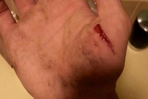 BoxingAnon's tweet image. This is why I don't play games #flashlighttag #almostERvisit