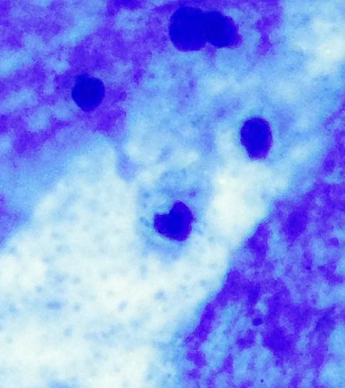 cristalballz's tweet image. Awww so cute! #microheart 😚💙💙💙💙💙💙