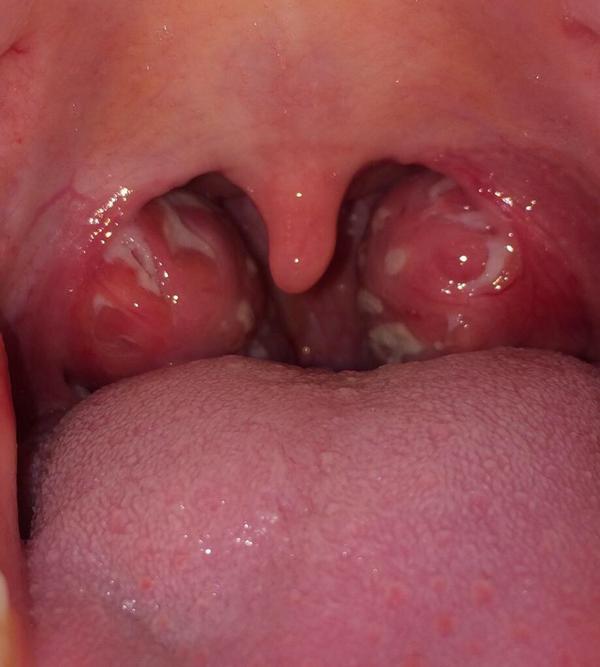 matthewg_559's tweet image. Retweet this or your going to wake up with it .