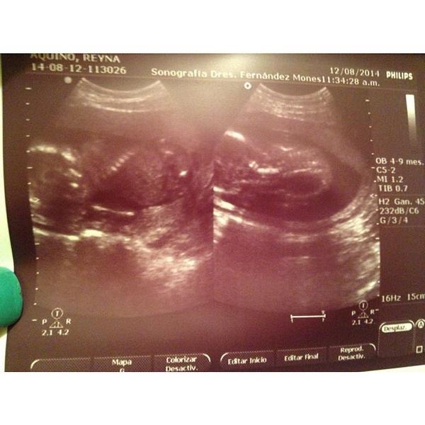_itsOsairis's tweet image. Frijolito it&apos;s a booooooooooy 😻😻 #Excited #Auntie #WaitingForHim 👏👏