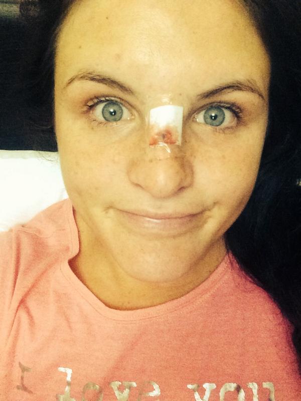 PoloKW12's tweet photo. Day 2 didn't end up well. Broken nose dislodged. Team played well. I'll be on the side lines to lead the team now :( http://t.co/ckvDL3NLR6