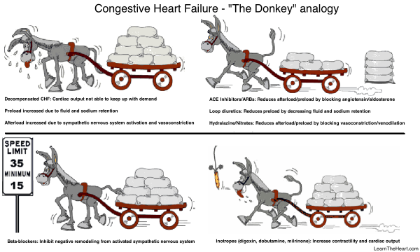MedClerkships's tweet photo. Congestive Heart Failure 
#Medicine #Cardiology   http://t.co/O32gTAADtN