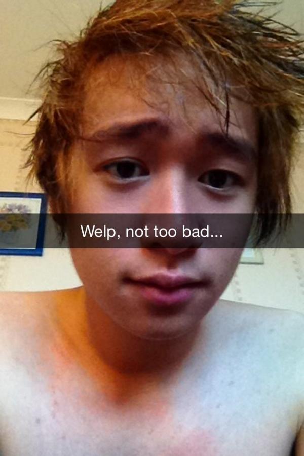 Drew James Fung On Twitter Bleached Hair Turned Ginger Ended Up
