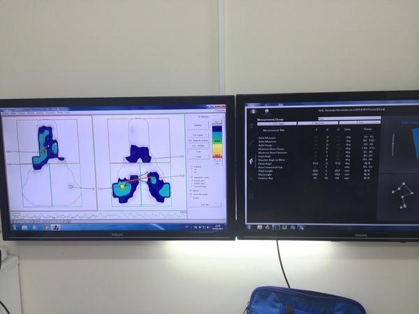 davidherrero2's tweet photo. Presiones y ángulos! Ambos en dinámico. Eso es lo importante en un estudio Biomecanico. vemos el antes y el después. http://t.co/Brw0ViL2en