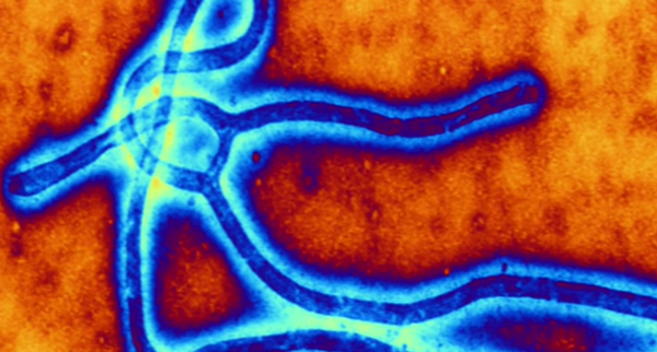 ThoughtCatalog's tweet photo. 13 Facts About The Deadly Ebola Virus That You Didn't Know http://t.co/0aSF9Abc8o http://t.co/MhUyaZEwr9