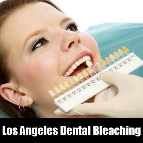 Los Angeles Dental Bleaching 

drkezian.com/los-angeles-te… 

#Ladentist #cosmeticdentist #dentalimplants #emergencydentis