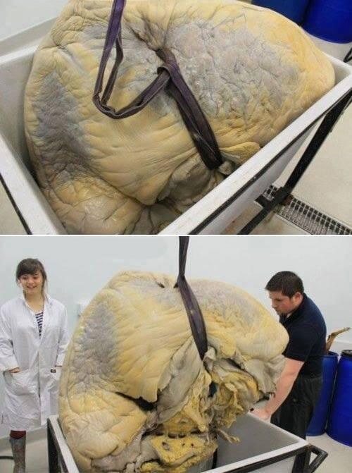 _Paisajes_'s tweet photo. Corazón de una ballena azul http://t.co/OYaoafoGj5