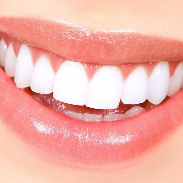 bedazzledhandb's tweet photo. Teeth whitening £69 or 2 people for £119 get up to 10 shades whiter!!! http://t.co/XBkg6oNjjJ