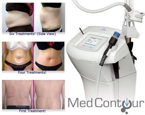 ContourGP's tweet image. 