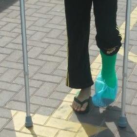 Broke my leg in <a href="/BounceIncOz/">BOUNCE inc</a>