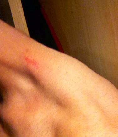 Normaaann's tweet photo. Fucking loved last night.. #hickie #nosleepingalone 😜 complications work themselves out trust me -- I'm so happy ⚡️⚡️ http://t.co/qurToMYRPv