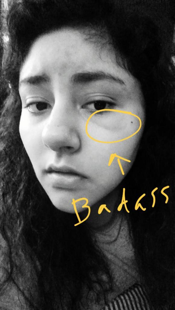 //dropped a book on my face (dance with dragons) now I have a bruise, reading can be dangerous kids take caution