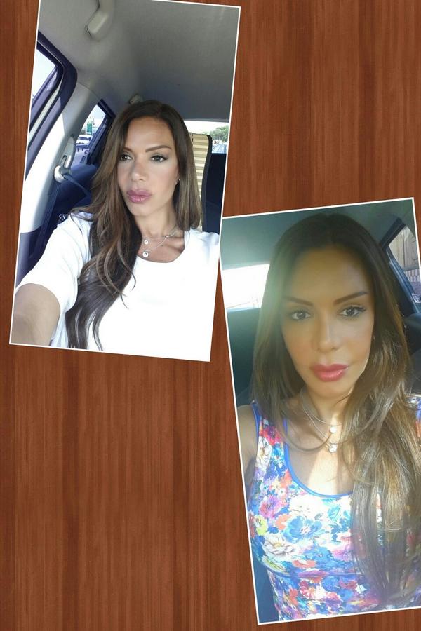 sevddemirel's tweet photo. Eski halim ve yeni halim seni seviyorum doktorum @imepestetik http://t.co/PclIBUhUxQ