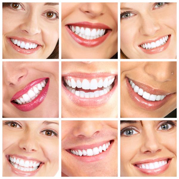 DentPlusVE's tweet photo. Tratamientos dentales de calidad y con resultados altamente estéticos y naturales. #DentplusVE #CuidadoDental http://t.co/NFls6nmRNK