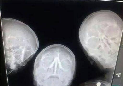Radiologists taking selfie