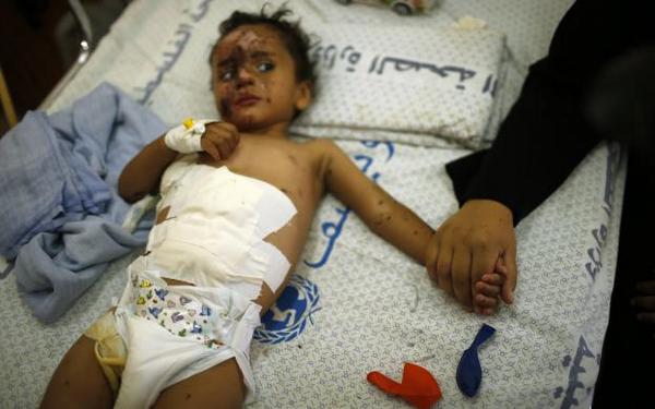 A Palestinian mother holds the hand of her son, wounded by shelling. Editor's Choice photos: reut.rs/1kWTeJm