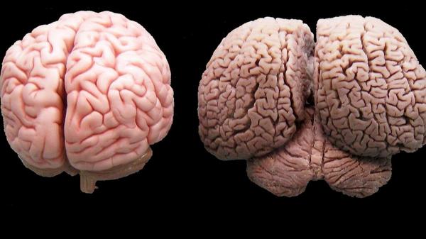 iHistorico's tweet image. Un cerebro de humano (izquierda) y un cerebro de delfín (derecha).