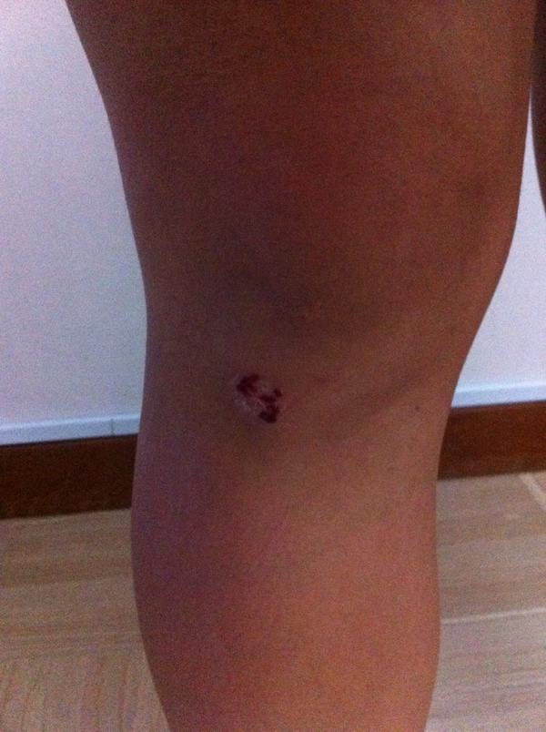 flibbery's tweet image. When was the last time you skinned you knees?!