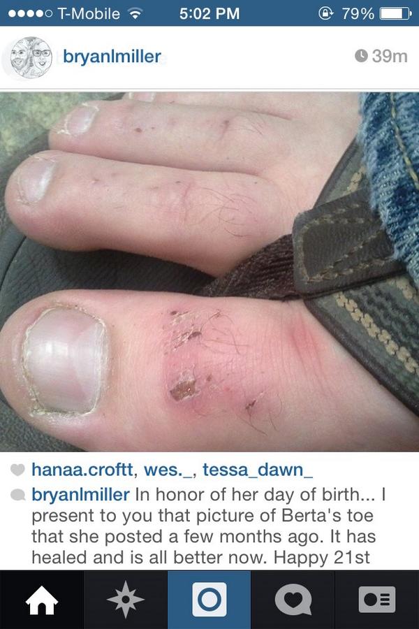 whittate's tweet photo. My life would be much better if @bryanlmiller would not have added this beauty to insta. I just can't do hairy toes. http://t.co/dslOQwNvCO