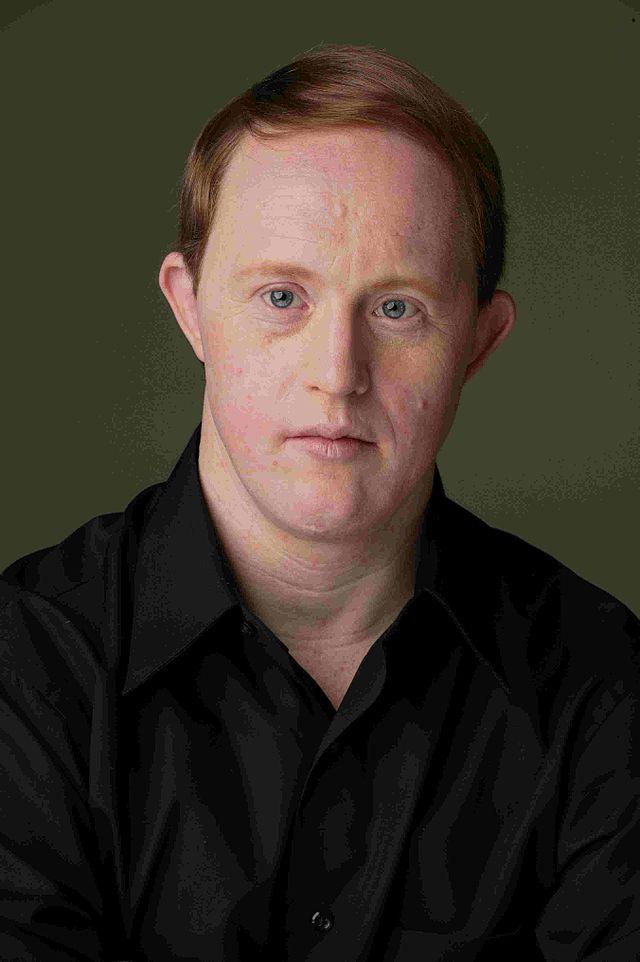 Happy 49th birthday, Chris Burke, the actor (down syndrome) who goes over the limits  