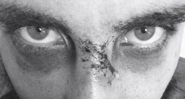 StuartBroad8's tweet photo. The Purge. http://t.co/cVwMOI8YYB
