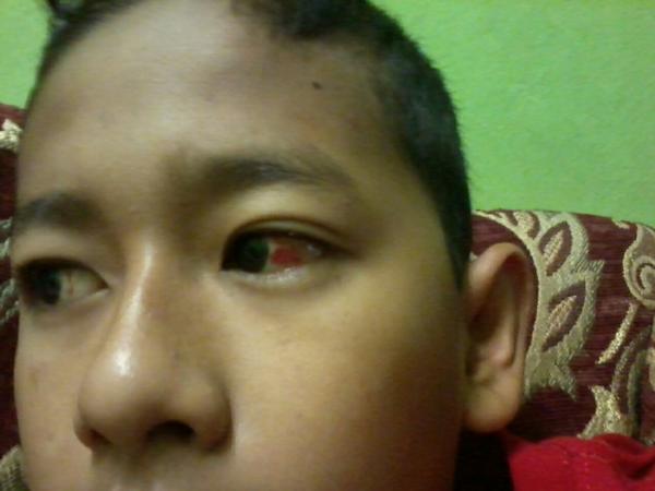 EnsemSufi's tweet photo. thats my eye.....

#lol http://t.co/Ndnwua3poc