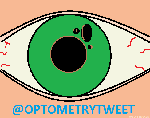 EyeCareAdvocate's tweet photo. Multiple pupils on an iris is known as #polycoria - #optometryfact #anatomy #iris #pupil http://t.co/eMTq0sPqrX