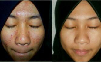 Medina SHOP tweet media