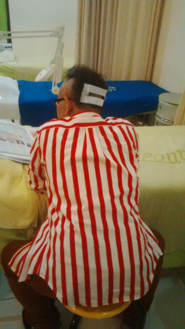 md_dee's tweet image. Persiapan Area Donor Hair Transplant sudah selesai..