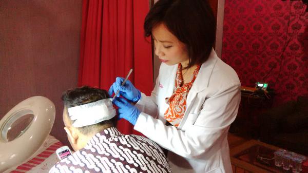 md_dee's tweet image. 1 hari setelah operasi Hair Transplant, Kita lihat yuk luka nya sudah sembuh belum yah...
#Hairtransplantjakarta